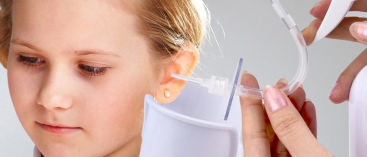 Ear Wax Removal Tool Review: Best Ear Wax Removal Kit for Easy Ear Cleaning